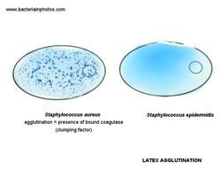 bound coagulase (latex agglutination) in staph aureus